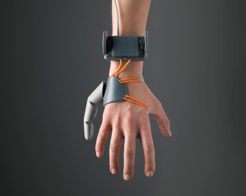 A splayed left hand with a robotic digit attached