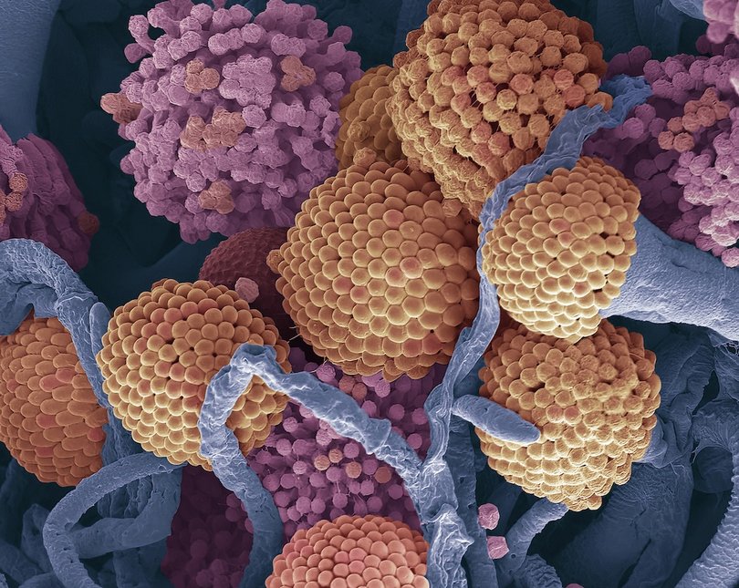 Image of purple and orange fungal spores