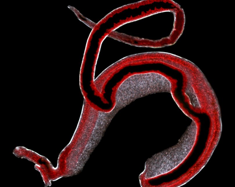 Image shows a red worm-like parasite